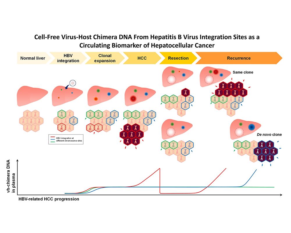 臺大肝炎研究團隊成功開發「病毒宿主嵌合DNA」 為B型肝炎病毒相關肝癌之新穎血液腫瘤標記-封面圖